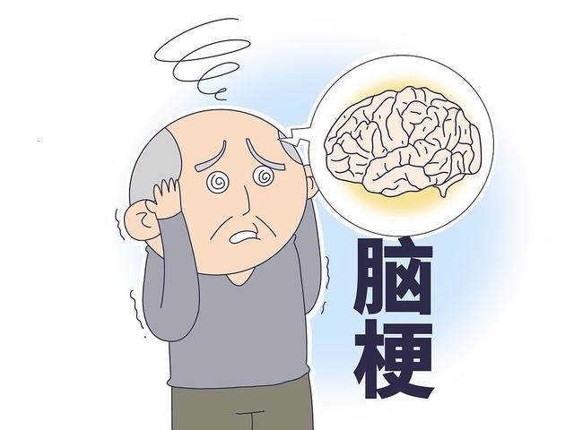 腦?；颊卟荒艹阅男〇|西?腦梗預(yù)防食物指南